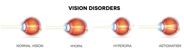 vision-disorders