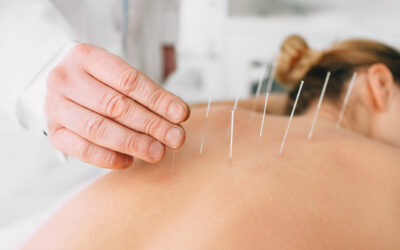 Why Choose Acupuncture If You Have Back Pain