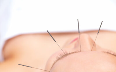 Acupuncture for the Treatment of Eye Disorders