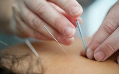 How Can Acupuncture Help Men with Infertility Issues?