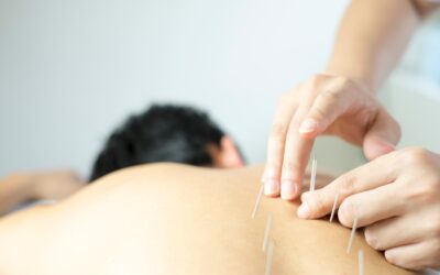 Why Choose Acupuncture over Painkillers?