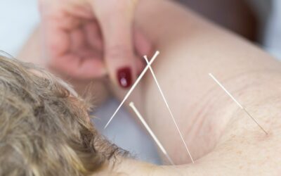 Relieving Seasonal Allergies with Acupuncture