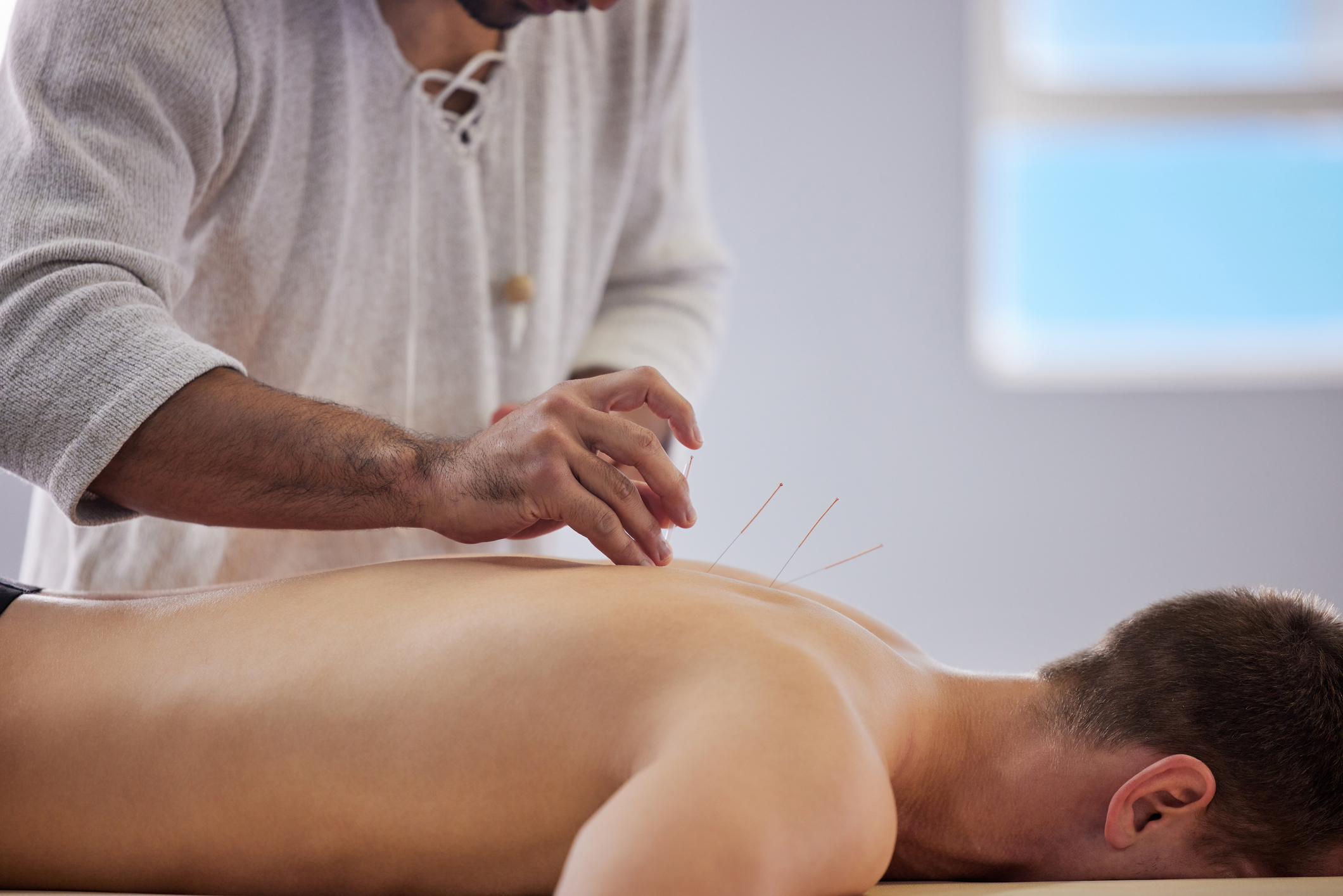 A close-up of an acupuncturist carefully inserting thin needles into a man's bare back during a treatment session. The patient lies face down on a massage table in a calm, well-lit room, highlighting the practice of traditional Chinese medicine for pain relief and relaxation.