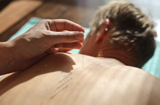 Acupuncture for Chronic Back Pain Relief in Albuquerque