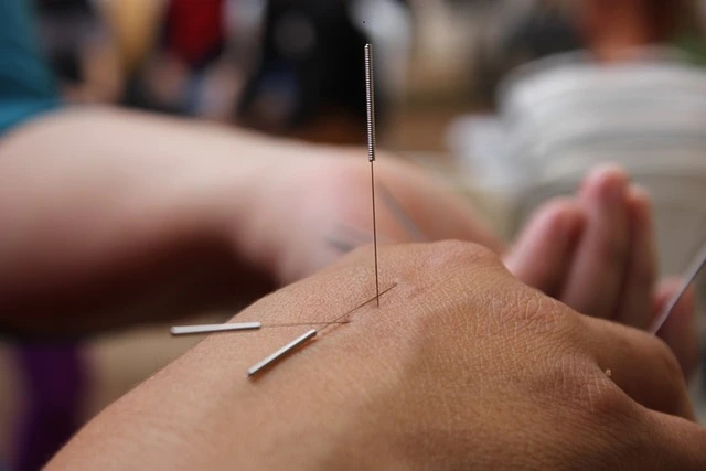 acupuncture-6324472_640