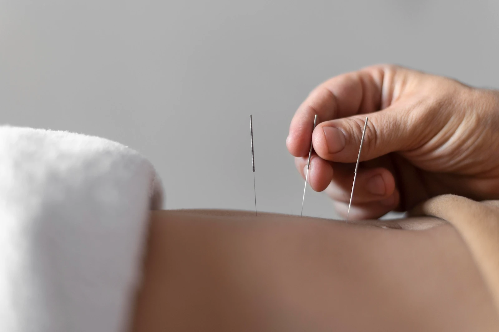 Fertility Specialist in Albuquerque providing acupuncture for reproductive health at Natural Life Acupuncture & Wellness